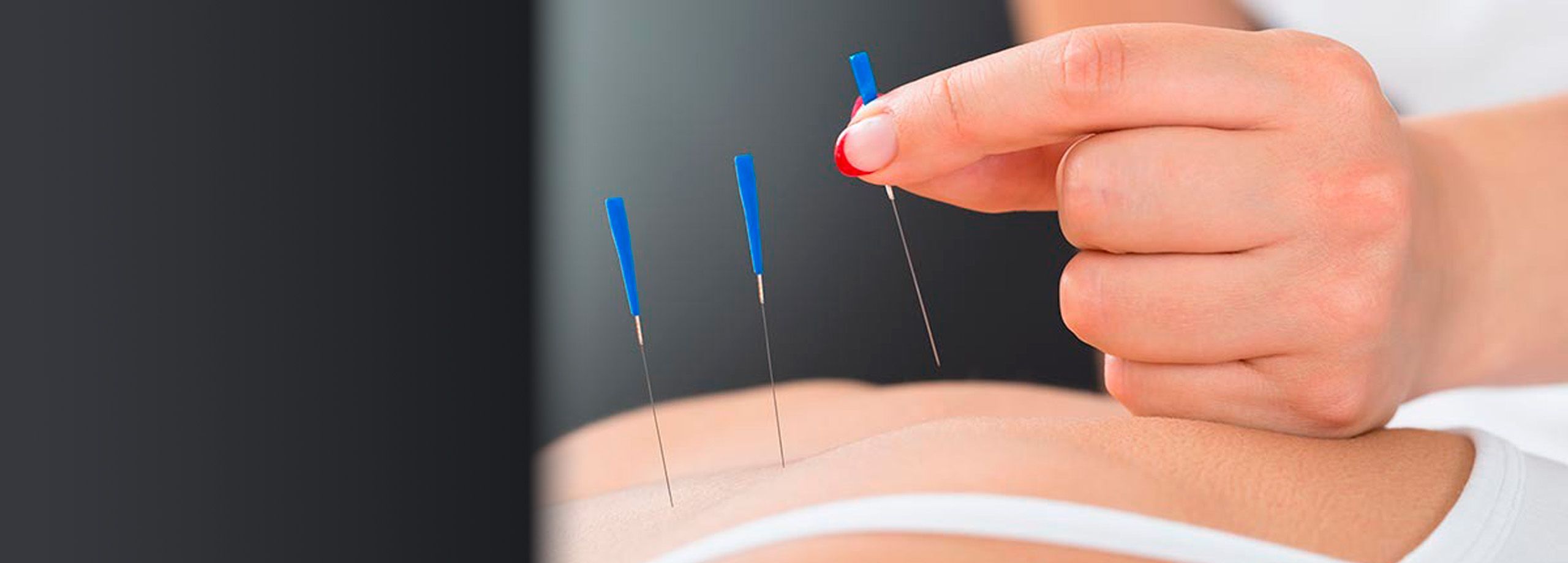 Curso de Acutomoterapia